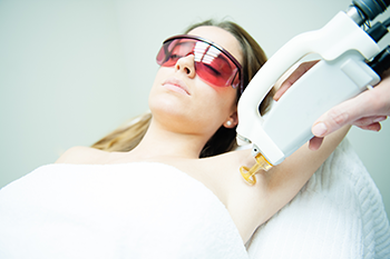 Laser Hair Removal at the Laser Hair Removal Center of the Treasure Coast